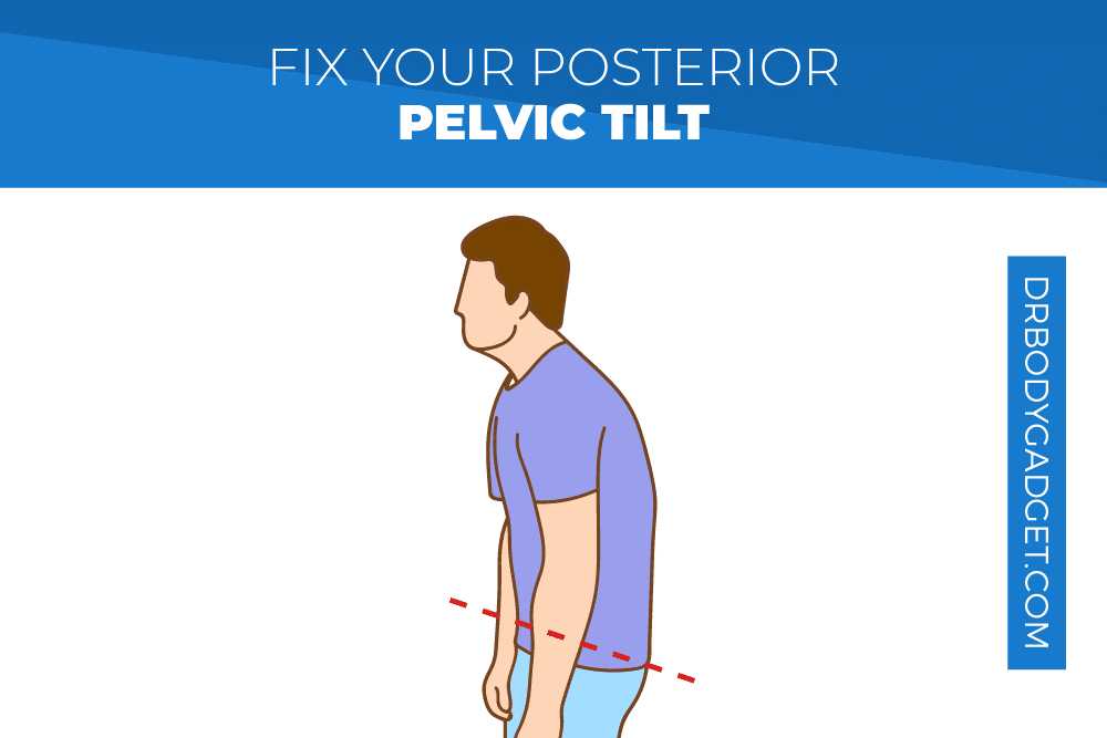 Posterior Causes Symptoms Treatment Posterior